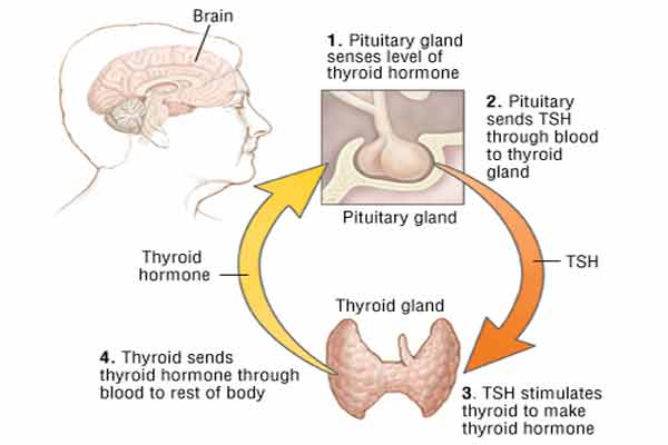 hypothyroidism gland